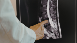 Spinal Cord Injury Attorneys